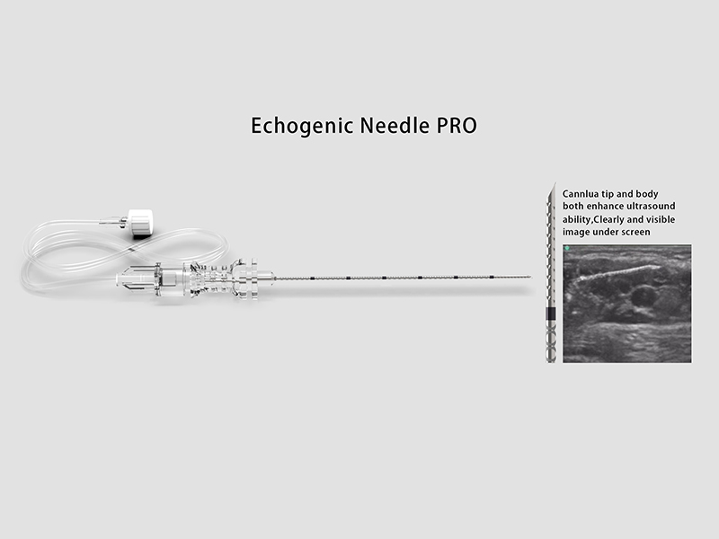 Ultrasound guided nerve block procedure highlighting needle visibility